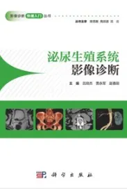 泌尿生殖系统影像诊断 影像诊断快速入门丛书