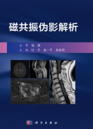 磁共振伪影解析