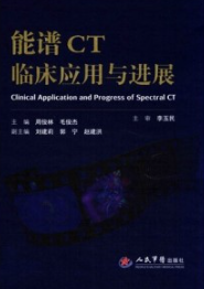 能谱CT临床应用与进展