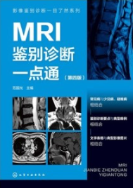 MRI鉴别诊断一点通（第四版）