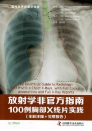 放射学非官方指南 100例胸部X线片实践