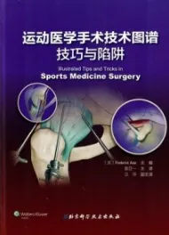 运动医学手术技术图谱技巧与陷阱