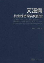 艾滋病机会性感染实例图谱