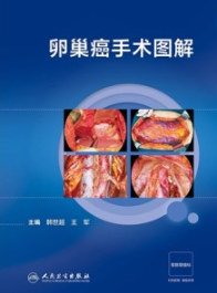 卵巢癌手术图解