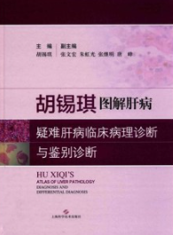 胡锡琪图解肝病 疑难肝病临床病理诊断与鉴别诊断