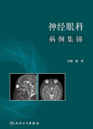 神经眼科病例集锦