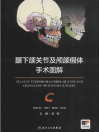 颞下颌关节及颅颌假体手术图解