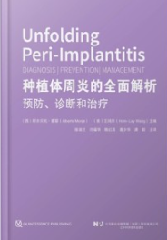 种植体周炎的全面解析 预防、诊断和治疗