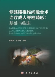 侧路腰椎椎间融合术治疗成人脊柱畸形 基础与临床