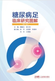 糖尿病足临床研究图解（第二版）