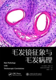 毛发镜征象与毛发病理