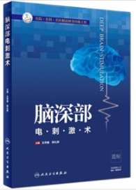 脑深部电刺激术