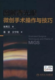 图解青光眼微创手术操作与技巧