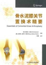 骨水泥膝关节置换术精要
