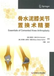 骨水泥膝关节置换术精要