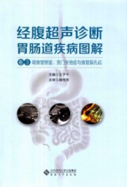 经腹超声诊断胃肠道疾病图解 卷3 咽食管憩室、贲门失弛症与食管裂孔疝