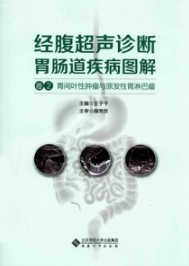 经腹超声诊断胃肠道疾病图解 卷2 胃间叶性肿瘤与原发性胃淋巴瘤