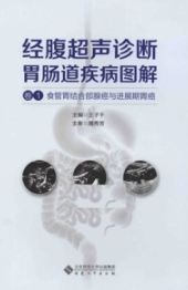 经腹超声诊断胃肠道疾病图解 卷1 食管胃结合部腺癌与进展期胃癌