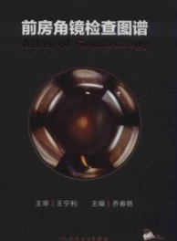 前房角镜检查图谱