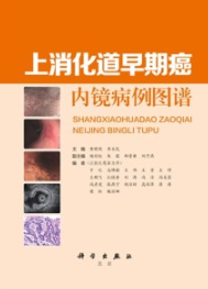 上消化道早期癌内镜病例图谱