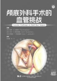 颅底外科手术的血管挑战