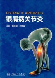 银屑病关节炎