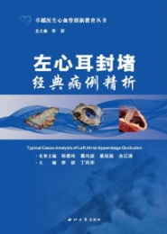左心耳封堵经典病例精析