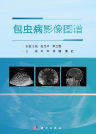 包虫病影像图谱