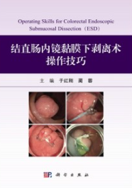 结直肠内镜黏膜下剥离术操作技巧