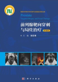 前列腺靶向穿刺与局灶治疗