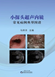 小探头超声内镜常见病例典型图谱