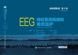 脑电图图谱 第3卷 神经系统疾病和重症监护