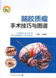 脑胶质瘤手术技巧与图谱