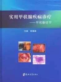 实用甲状腺疾病诊疗 甲状腺结节