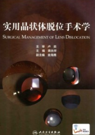 实用晶状体脱位手术学