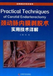 颈动脉内膜剥脱术实用技术详解