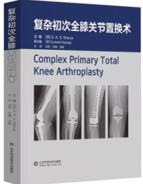 复杂初次全膝关节置换术