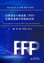 自体富血小板血浆（PRP）在修复重建中的临床应用