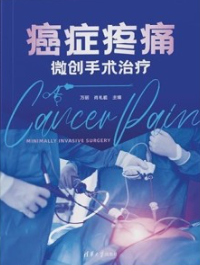 癌症疼痛微创手术治疗