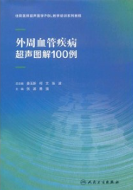 外周血管疾病超声图解100例