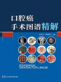 口腔癌手术图谱精解