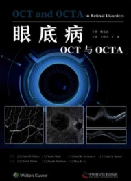 眼底病OCT与OCTA
