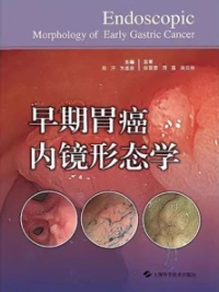 早期胃癌内镜形态学