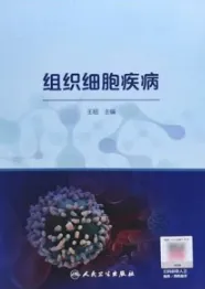 组织细胞疾病