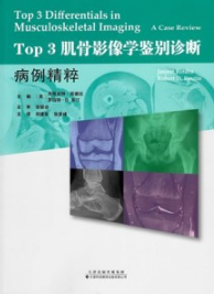 Top3 肌骨影像学鉴别诊断 病例精粹