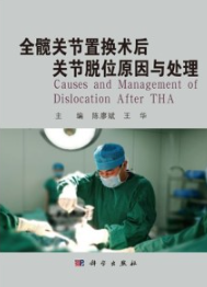 全髋关节置换术后关节脱位原因与处理