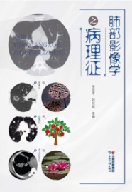 肺部影像学之病理征