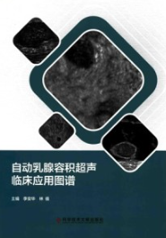 自动乳腺容积超声临床应用图谱