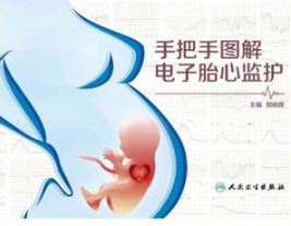 手把手图解电子胎心监护