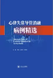 心律失常导管消融病例精选